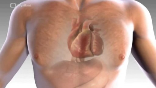 Transplantace srdce