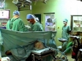 Laparoskopická operace tlustého střeva