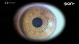 Oko a kmenov buňky