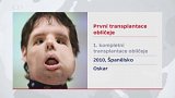 První transplantace obličeje