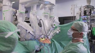 Prodloužená ruka robota - precizní chirurgie s novými roboty